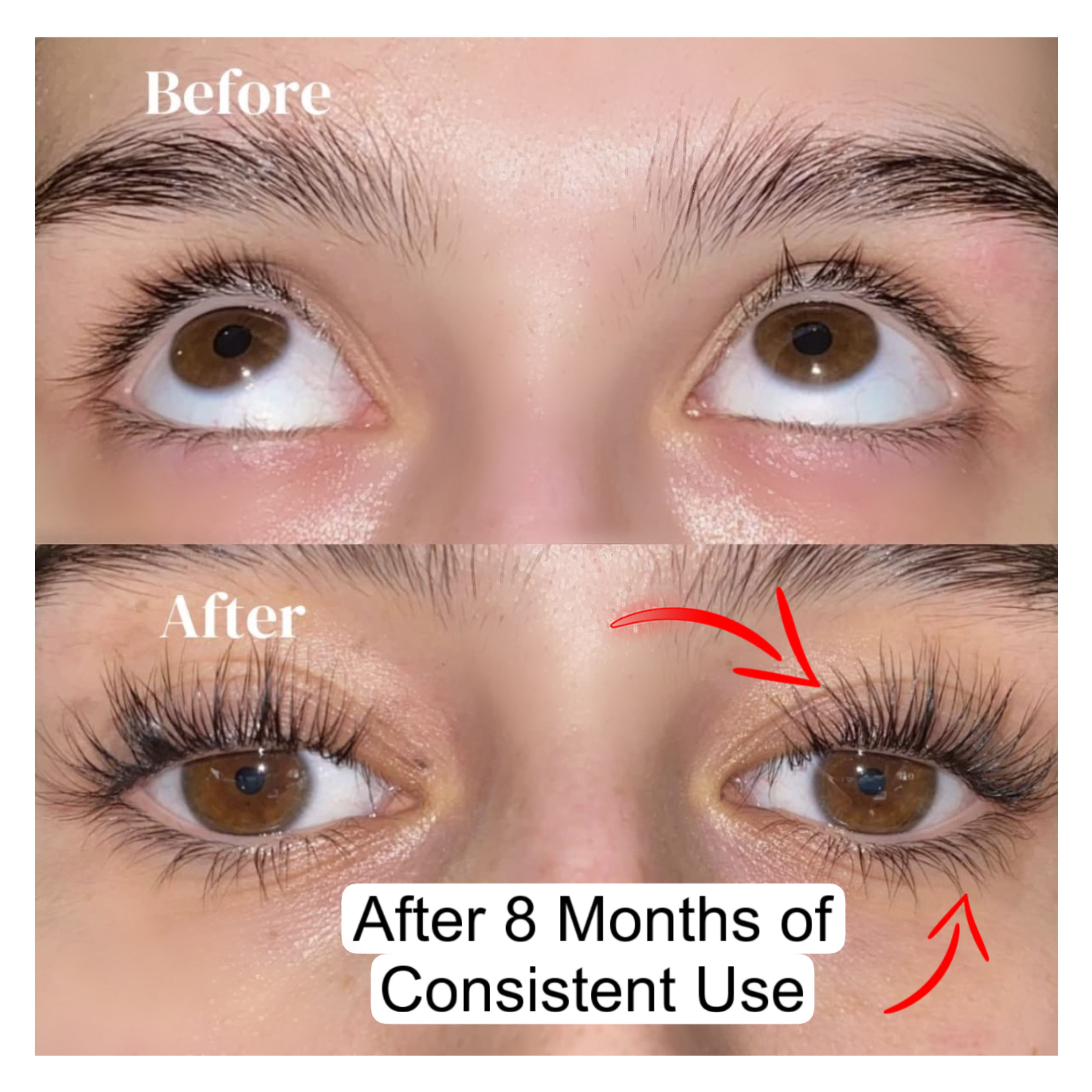 Eye Lash Growth